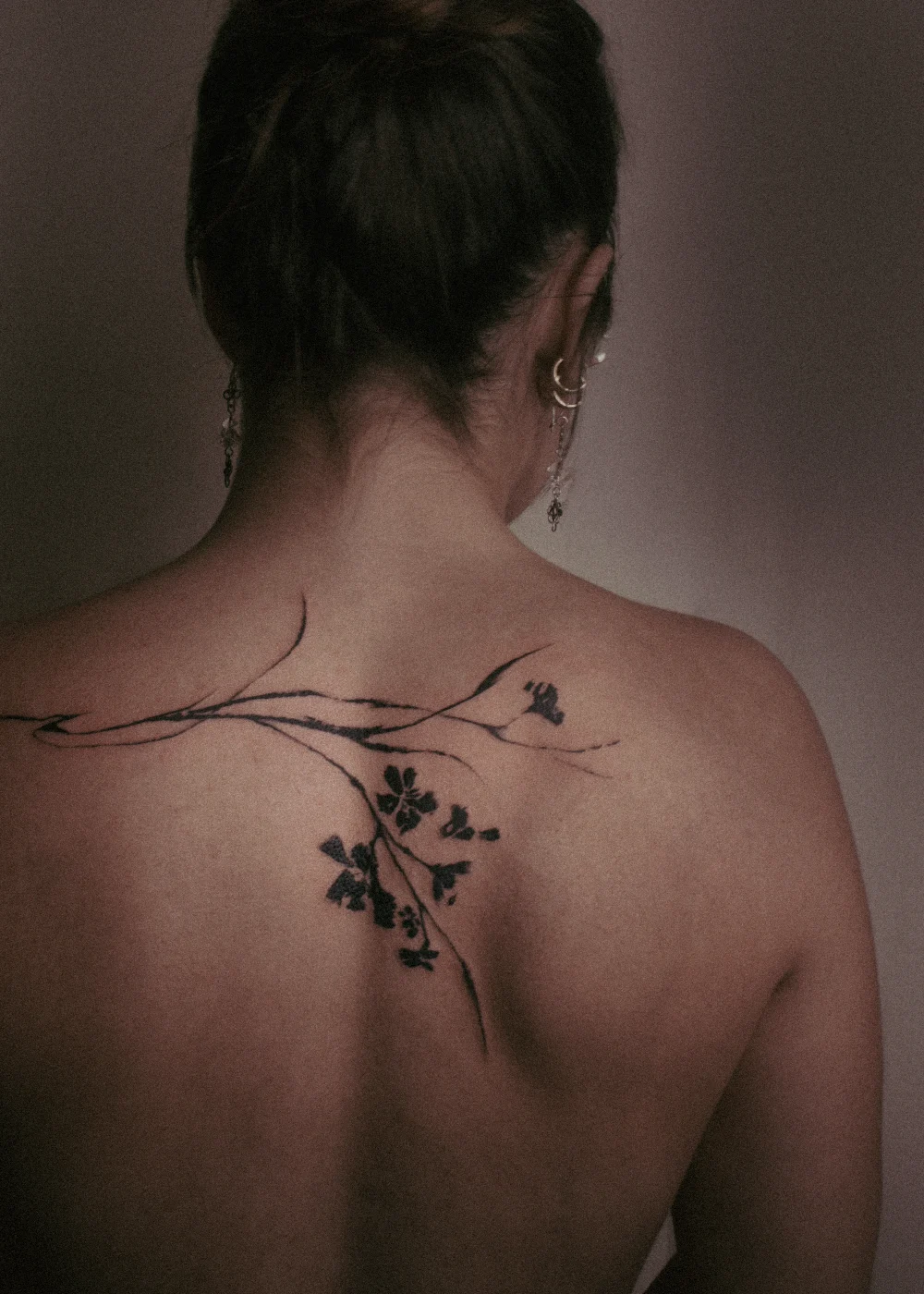 Healed, upper back
