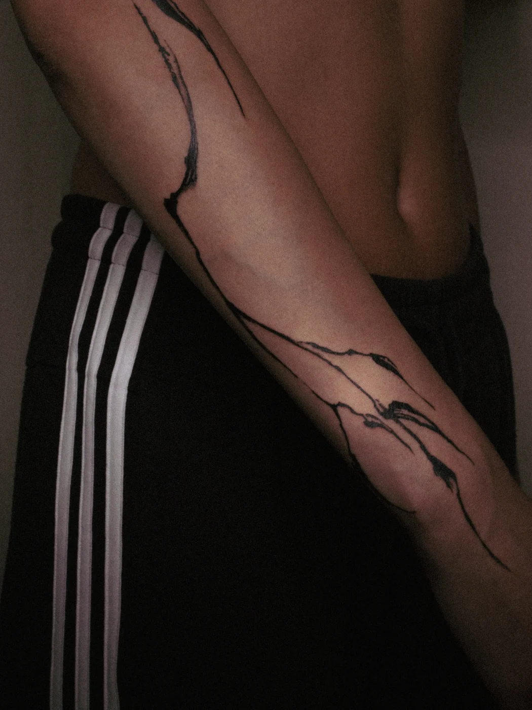 Healed, forearm