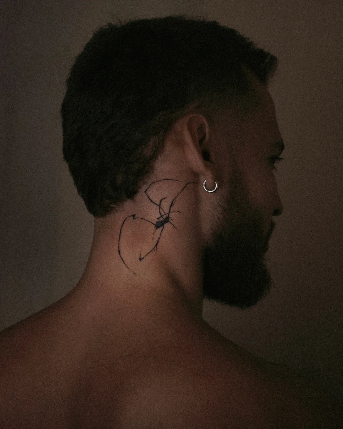 Healed, neck