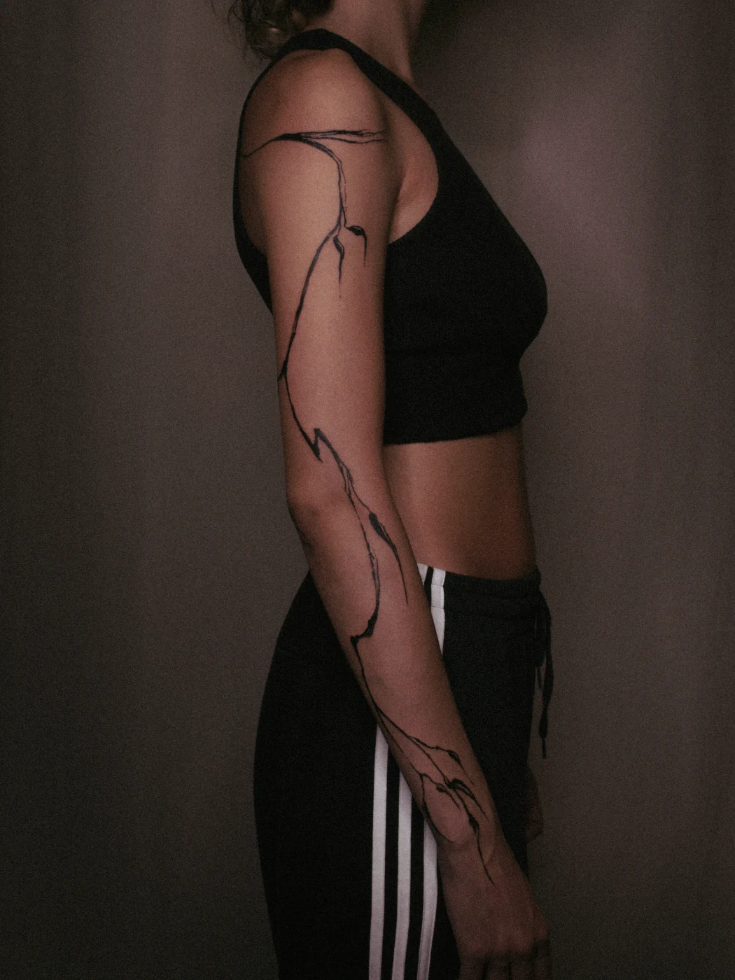 Healed, arm